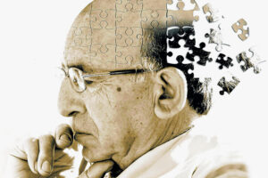 Doença de Alzheimer